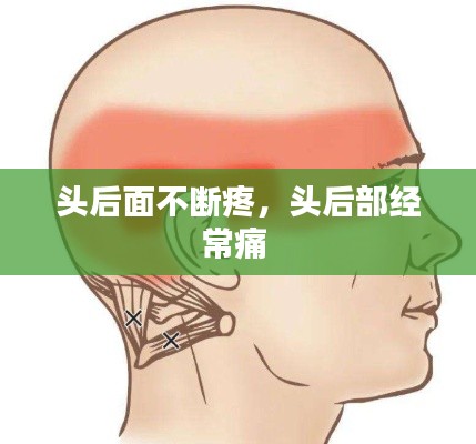 头后面不断疼,头后部经常痛