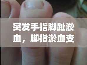 突发手指脚趾淤血,脚指淤血变黑